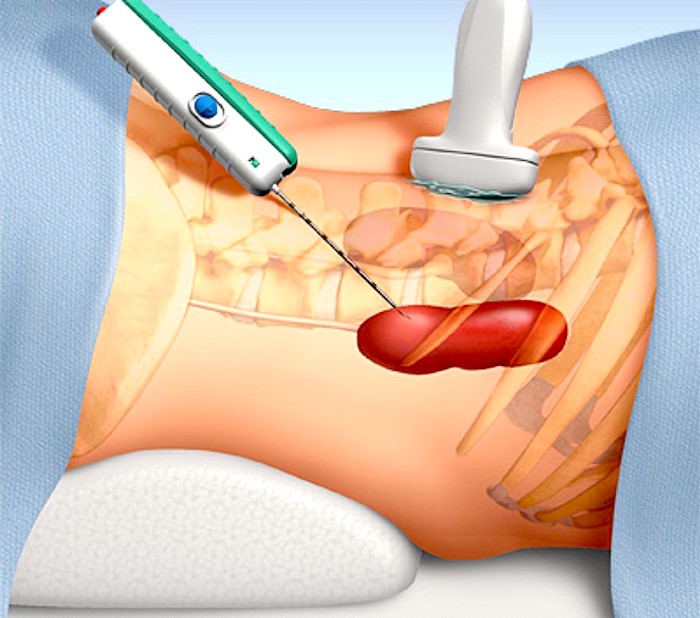Detalle del servicio Biopsia renal 2